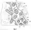 Fig. 08 - Extremity Fusion Plate Assembly