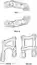 Fig. 20 - Extremity Fusion Plate Assembly
