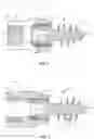 Fig. 04 - Surgical implant and method of use
