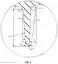 Fig. 05 - Surgical implant and method of use