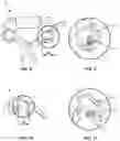 Fig. 07 - Surgical implant and method of use