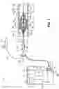 Fig. 02 - Catheter system for valvuloplasty procedure