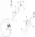 Fig. 32 - Methods of treating nasal airways