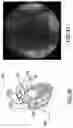 Fig. 19 - Ablation Assembly to Treat Target Regions of Tissue in Organs