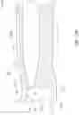 Fig. 14 - SURGICAL DEVICE, LASER SURGERY SYSTEM, AND METHODS OF OPERATION THEREOF