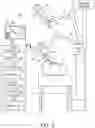Fig. 02 - Robotic surgery