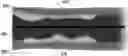 Fig. 01 - SYSTEMS AND METHODS FOR LASER-INDUCED CALCIUM FRACTURES