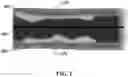 Fig. 02 - SYSTEMS AND METHODS FOR LASER-INDUCED CALCIUM FRACTURES