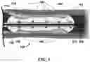 Fig. 04 - SYSTEMS AND METHODS FOR LASER-INDUCED CALCIUM FRACTURES