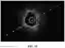 Fig. 16 - SYSTEMS AND METHODS FOR LASER-INDUCED CALCIUM FRACTURES