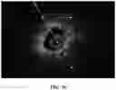 Fig. 17 - SYSTEMS AND METHODS FOR LASER-INDUCED CALCIUM FRACTURES