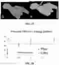 Fig. 27 - SYSTEMS AND METHODS FOR LASER-INDUCED CALCIUM FRACTURES
