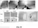 Fig. 28 - SYSTEMS AND METHODS FOR LASER-INDUCED CALCIUM FRACTURES