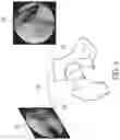 Fig. 04 - Systems and methods for generating a three-dimensional model of a joint from two-dimensional images