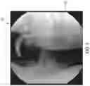 Fig. 06 - Systems and methods for generating a three-dimensional model of a joint from two-dimensional images
