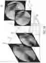 Fig. 08 - Systems and methods for generating a three-dimensional model of a joint from two-dimensional images
