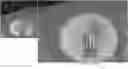 Fig. 01 - Systems and methods for registration of intra-body electrical readings with a pre-acquired three dimensional image