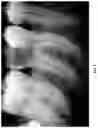 Fig. 02 - 3D DATA GENERATION FOR PROSTHETIC CROWN PREPARATION OF TOOTH