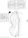 Fig. 03 - 3D DATA GENERATION FOR PROSTHETIC CROWN PREPARATION OF TOOTH