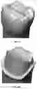 Fig. 06 - 3D DATA GENERATION FOR PROSTHETIC CROWN PREPARATION OF TOOTH