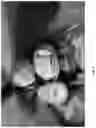 Fig. 09 - 3D DATA GENERATION FOR PROSTHETIC CROWN PREPARATION OF TOOTH