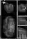 Fig. 16 - 3D DATA GENERATION FOR PROSTHETIC CROWN PREPARATION OF TOOTH