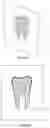 Fig. 17 - 3D DATA GENERATION FOR PROSTHETIC CROWN PREPARATION OF TOOTH