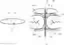 Fig. 01 - Fastening System For A Dental Object