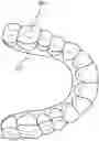 Fig. 01 - DENTAL ALIGNERS AND PROCEDURES FOR ALIGNING TEETH