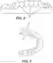 Fig. 06 - DENTAL ALIGNERS AND PROCEDURES FOR ALIGNING TEETH