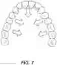 Fig. 07 - DENTAL ALIGNERS AND PROCEDURES FOR ALIGNING TEETH
