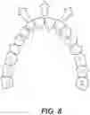 Fig. 08 - DENTAL ALIGNERS AND PROCEDURES FOR ALIGNING TEETH