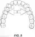 Fig. 09 - DENTAL ALIGNERS AND PROCEDURES FOR ALIGNING TEETH