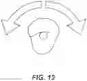 Fig. 13 - DENTAL ALIGNERS AND PROCEDURES FOR ALIGNING TEETH