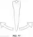 Fig. 17 - DENTAL ALIGNERS AND PROCEDURES FOR ALIGNING TEETH