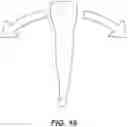 Fig. 18 - DENTAL ALIGNERS AND PROCEDURES FOR ALIGNING TEETH