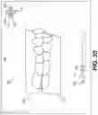 Fig. 20 - DENTAL ALIGNERS AND PROCEDURES FOR ALIGNING TEETH