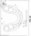 Fig. 22 - DENTAL ALIGNERS AND PROCEDURES FOR ALIGNING TEETH