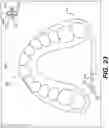 Fig. 23 - DENTAL ALIGNERS AND PROCEDURES FOR ALIGNING TEETH