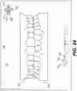 Fig. 24 - DENTAL ALIGNERS AND PROCEDURES FOR ALIGNING TEETH