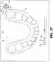 Fig. 27 - DENTAL ALIGNERS AND PROCEDURES FOR ALIGNING TEETH