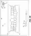 Fig. 29 - DENTAL ALIGNERS AND PROCEDURES FOR ALIGNING TEETH