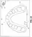 Fig. 33 - DENTAL ALIGNERS AND PROCEDURES FOR ALIGNING TEETH