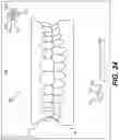 Fig. 34 - DENTAL ALIGNERS AND PROCEDURES FOR ALIGNING TEETH