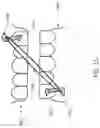 Fig. 37 - Replacement attachment system