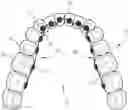 Fig. 01 - METHOD FOR MANUFACTURING A FITTING DEVICE FOR AN ORTHODONTIC APPARATUS