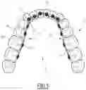 Fig. 02 - METHOD FOR MANUFACTURING A FITTING DEVICE FOR AN ORTHODONTIC APPARATUS
