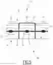 Fig. 06 - METHOD FOR MANUFACTURING A FITTING DEVICE FOR AN ORTHODONTIC APPARATUS