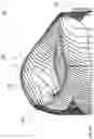 Fig. 06 - Method of making dental restorations from sintered preforms