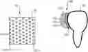 Fig. 01 - Dental object with an adhesive region